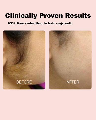 Reveal Silky Skin, Embrace Your Confidence