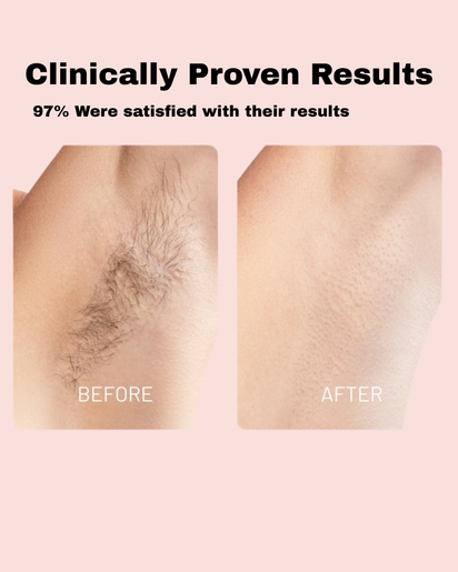 Natural Neriva Hair Removal Oil