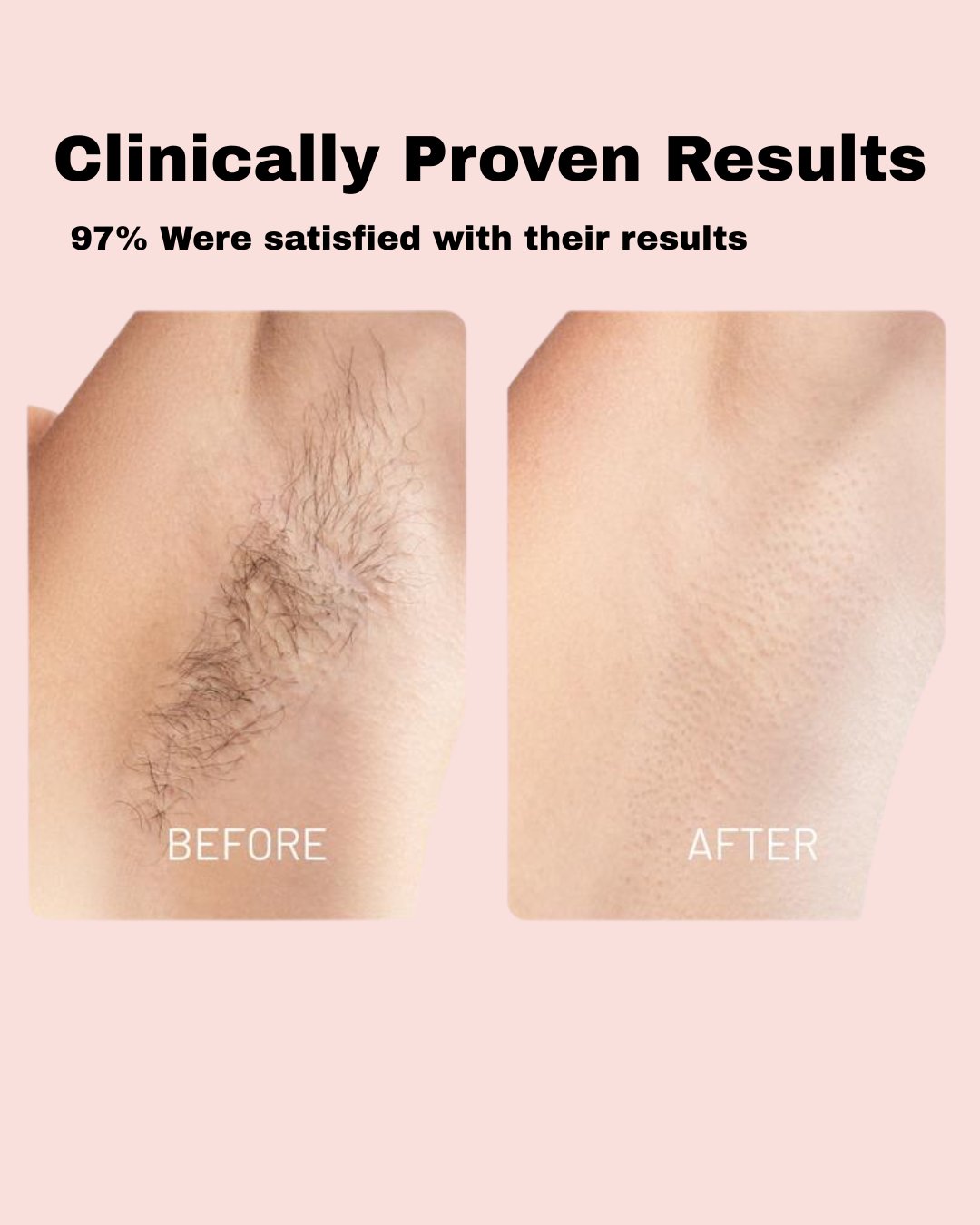 Natural Neriva Hair Removal Oil